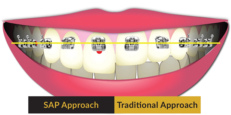 smile design