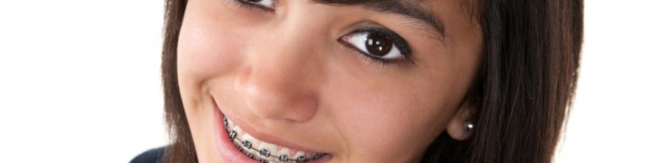 signs symptoms that your child needs braces
