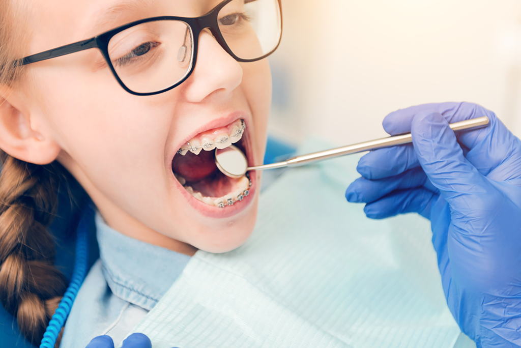 What are the Options for Orthodontics Treatment?