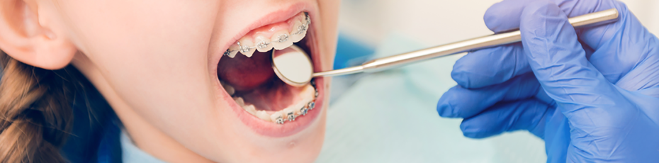 options for orthodontics treatment