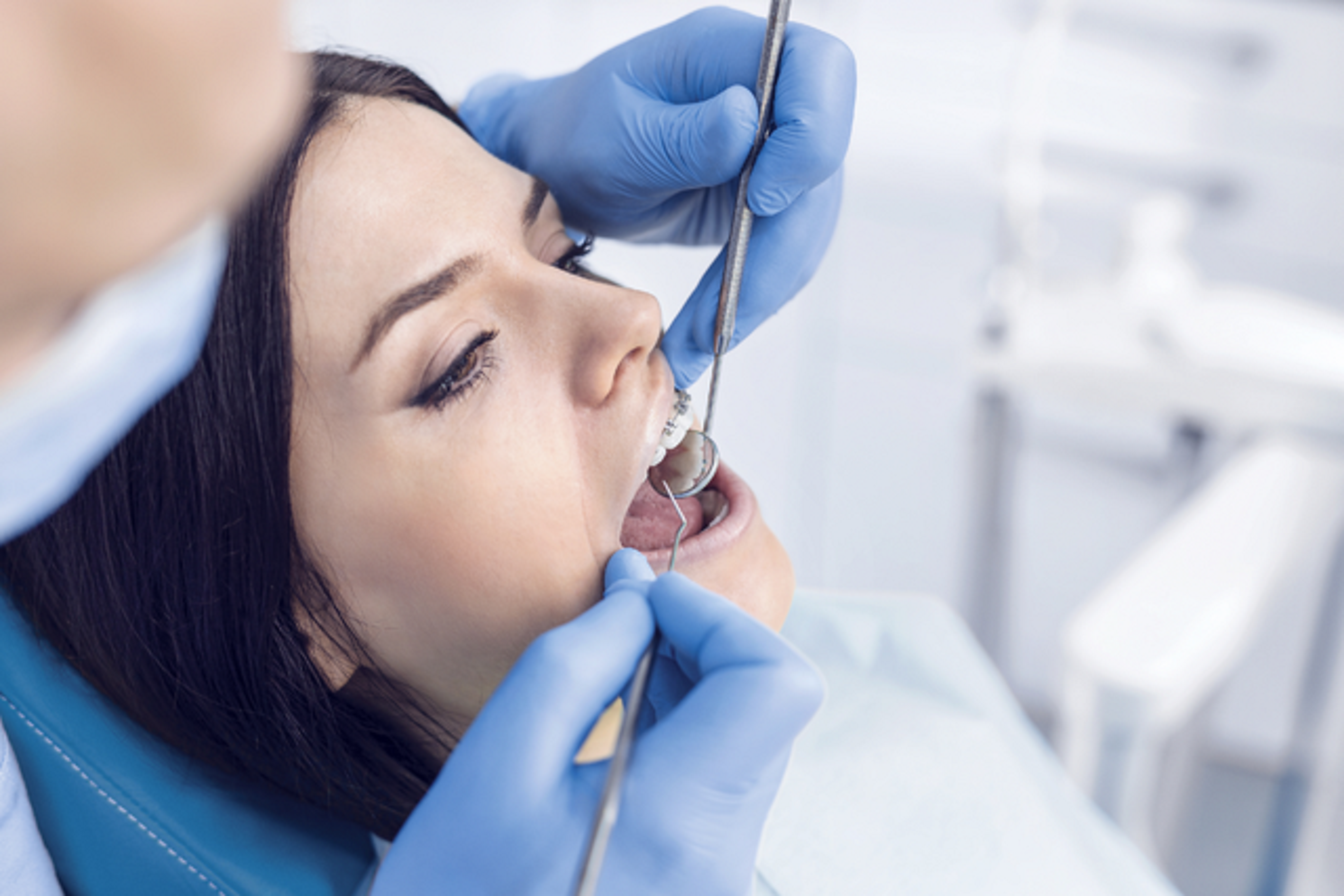 orthodontist treatment in Irvine
