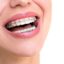 benefits of adult orthodontics