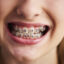 choosing the right orthodontist tips for finding the best provider